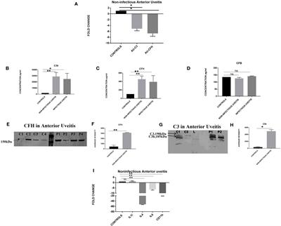 Exploring the involvement of the alternative complement pathway in non-infectious uveitis pathogenesis